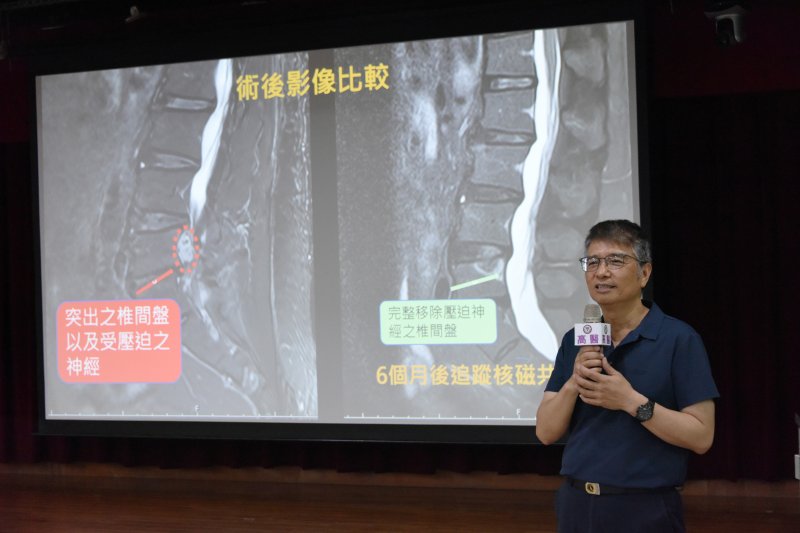 高醫「脊椎微創內視鏡」手術助重拾行動力改變傳統手術缺點