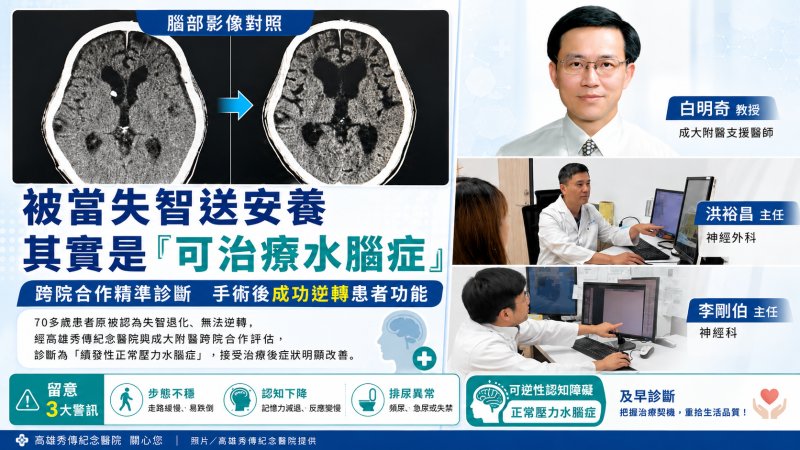 被當失智送安養　其實是「可治療水腦症」 跨院合作精準診斷手術後成功逆轉患者功能